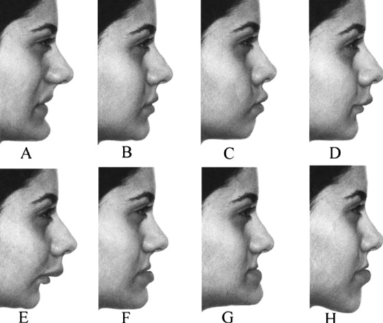 Facial Assessments for Kids